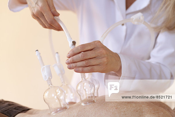 Female alternatiße practitioner treating senior woman with ßacuum cupping therapy