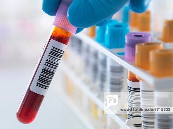 Eine Blutprobe  die mit einer Reihe von menschlichen Proben für analytische Tests einschließlich Blut  Urin  Chemie  Proteinen  Antikoagulantien und HIV im Labor aufbewahrt wird.