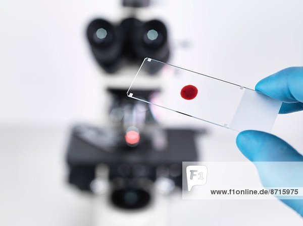 Laborwissenschaftler hält einen Objektträger mit einer Blutprobe mit einem aufrechten Verbundmikroskop im Hintergrund.