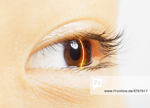 Extreme close up of laser scanning brown eye