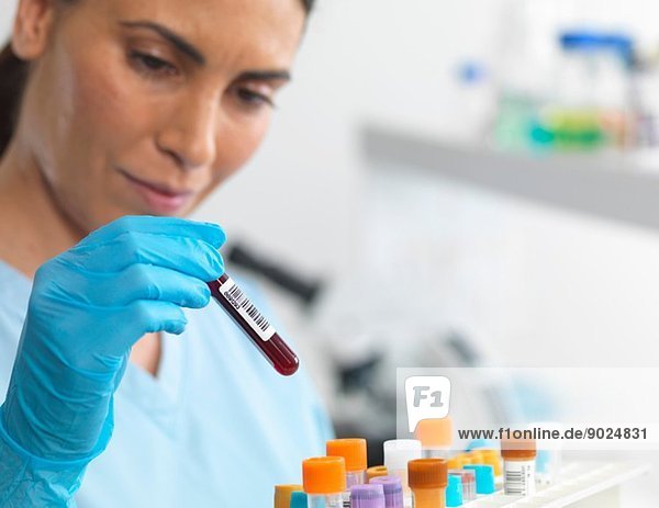 Wissenschaftler besichtigen verschiedene menschliche Proben für Tests im Labor