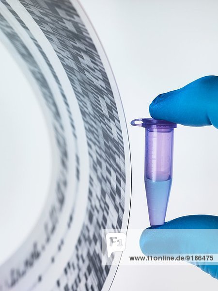 Genprobe und DNA-Autoradiogramm