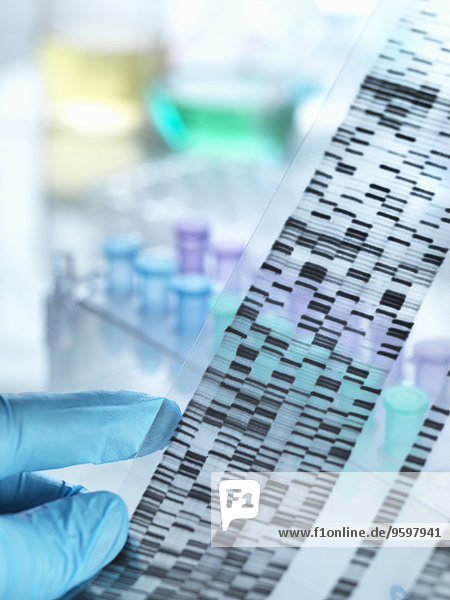 Wissenschaftler hält DNA-Gel vor Proben für Laboruntersuchungen
