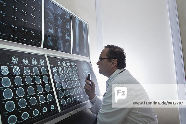 Arzt starrt auf Scans des Gehirns auf dem Leuchtkasten
