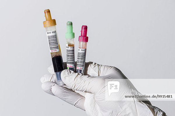 Hand eines Laboranten hält drei Monovetten mit Serum  Citrat und EDTA
