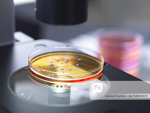 Petrischale mit Bakterienkultur wird im mikrobiologischen Labor unter dem Inversmikroskop untersucht
