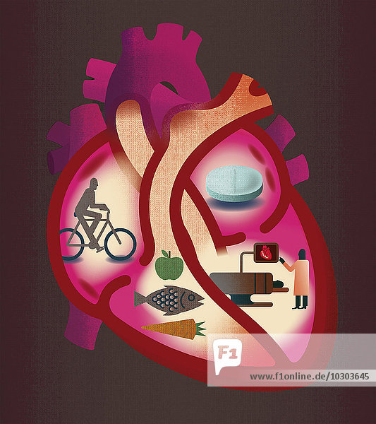 Querschnitt eines Herzens mit Gegenüberstellung von Herzkrankheiten und gesundem Leben