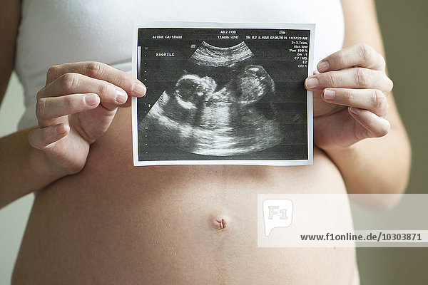 Schwangere mit Ultraschallbild,  Mittelteil