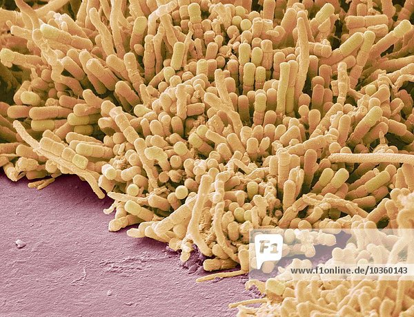 Plaque-bildende Bakterien  SEM
