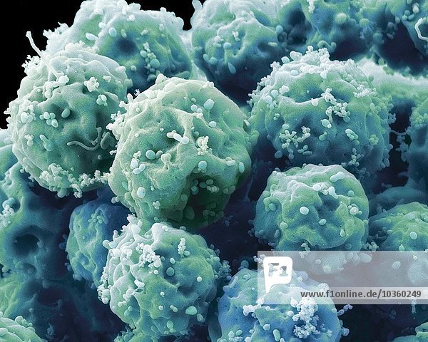 Embryonale Stammzellen  SEM