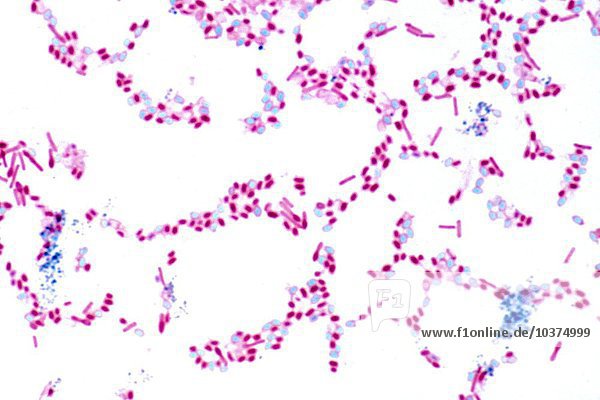 microbiology-gram-positive-bacilli-youtube