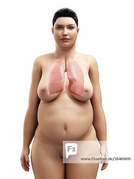 Die Lunge einer fettleibigen Frau  Kunstwerk