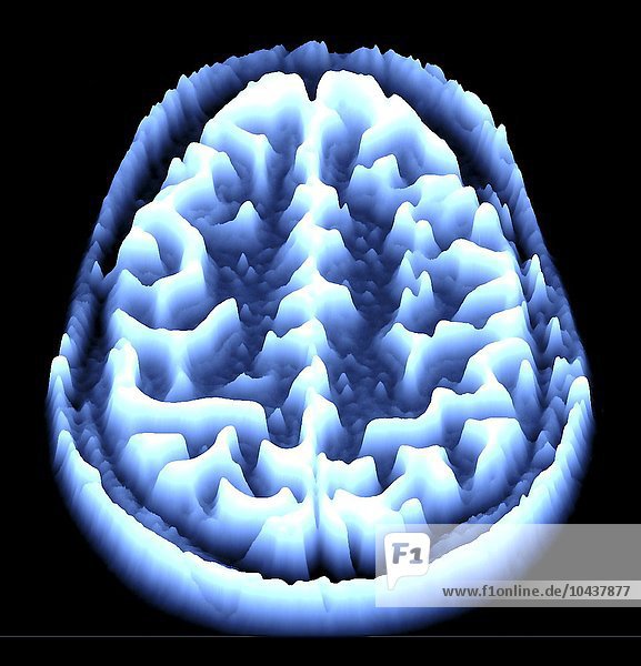 Normales Gehirn. Farbige Magnetresonanztomographie (MRT) eines axialen Schnitts durch ein gesundes Gehirn  umgewandelt in eine Höhenkarte oder ein Höhenfeld. Die Vorderseite des Gehirns befindet sich im oberen Teil des Bildes. Hier sieht man das Großhirn  den größten Teil des Gehirns. Es ist in zwei Gehirnhälften unterteilt und für bewusstes Denken  Emotionen und willkürliche Bewegungen verantwortlich. Gehirnscan  MRI-Scan  Höhenkarte