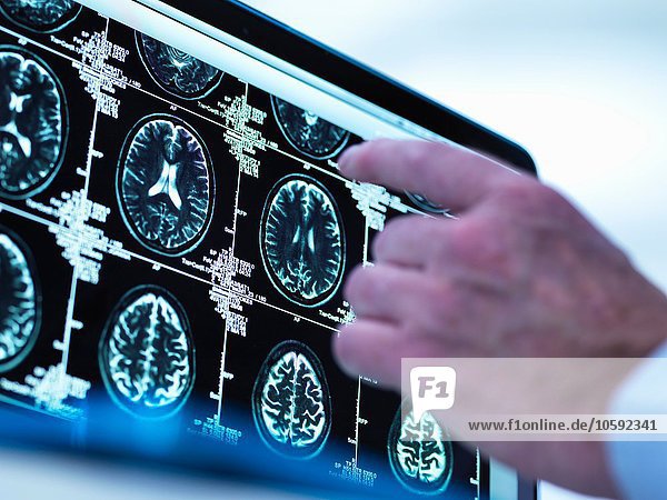 Arzt  der eine Reihe von MRT (Magnetresonanztomographie)-Gehirnscans auf einem Bildschirm betrachtet.