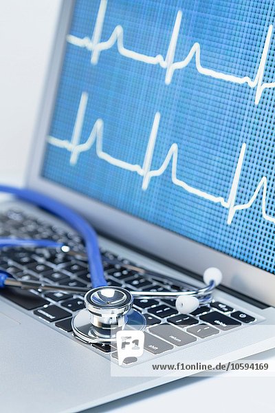 Moderne Kardiologie. Akustisches Stethoskop auf einem Laptop  das eine EKG-Spur anzeigt.