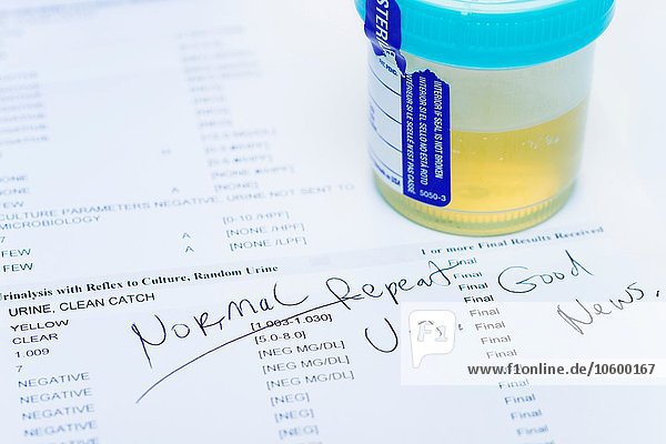 Studioaufnahme der Urinprobe auf einem Testausdruck mit normalen Ergebnissen. Die Tests werden im Rahmen eines jährlichen Gesundheitschecks durchgeführt.
