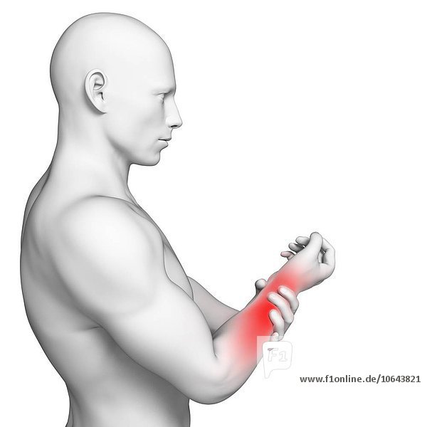 Human wrist pain  artwork