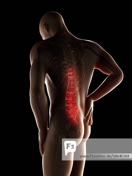 Human back pain artwork
