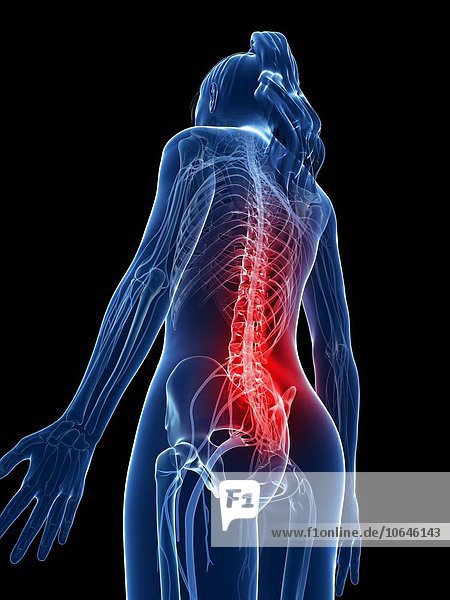 Human back pain,  artwork