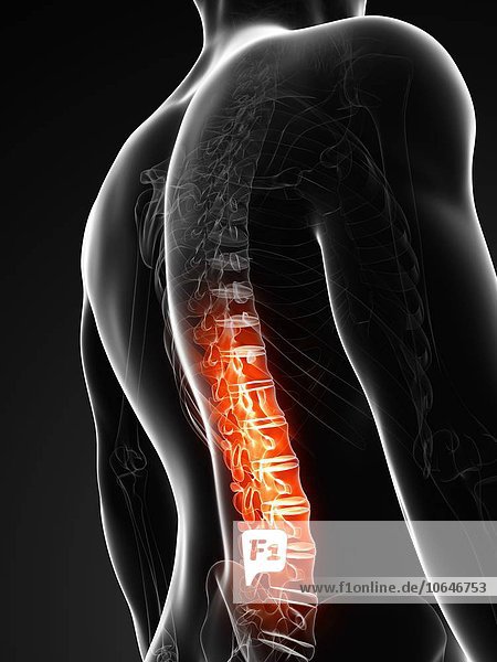 Human back pain  artwork