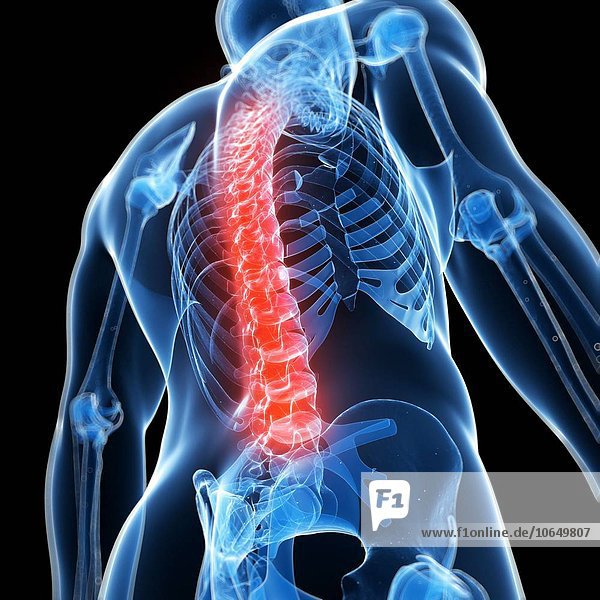 Human back pain  artwork