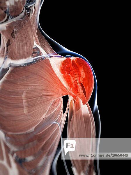 Human shoulder pain  artwork