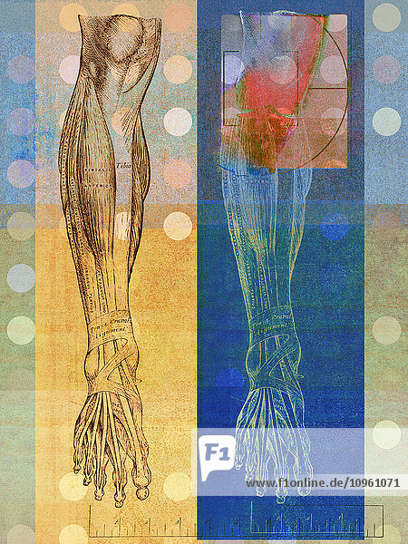 Anatomische Illustration eines menschlichen Beins mit Knieproblem