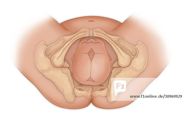 Doctor's view of a baby in occipital posterior position