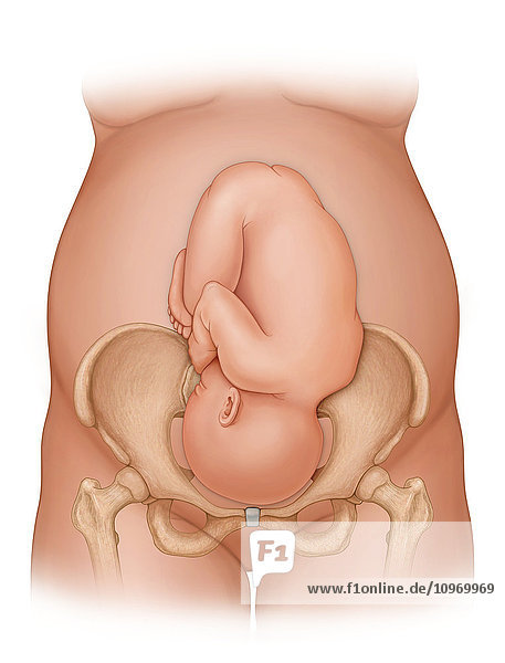 Front view of a woman nine months pregnant (baby phantomed within) ready for delivery  with baby in proper position for delivery