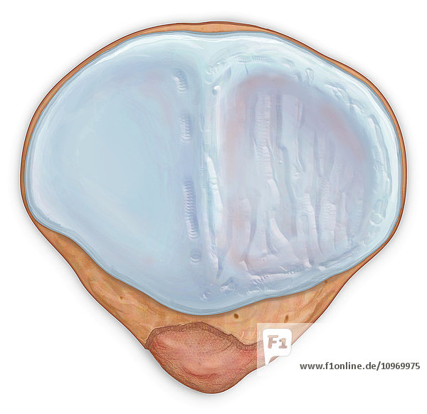 Posterior view patellar surface showing and injured cartilage surface