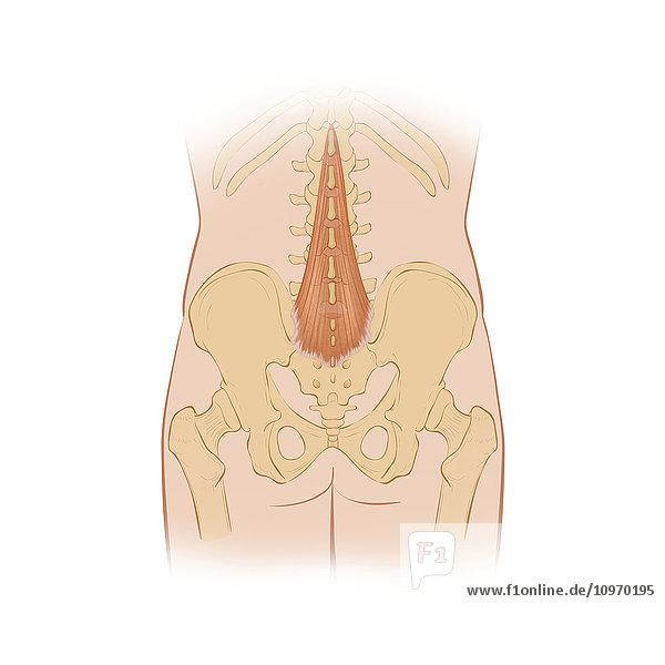 Normal posterior view of the back highlighting the multifidus muscle