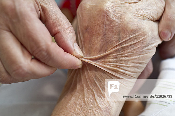 Prüfung der Haut auf Exsikkose im Seniorenheim