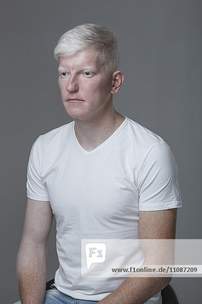 Young albino man sitting against gray background