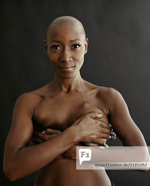 Nackte afroamerikanische Krebsüberlebende  die ihre Brüste bedeckt