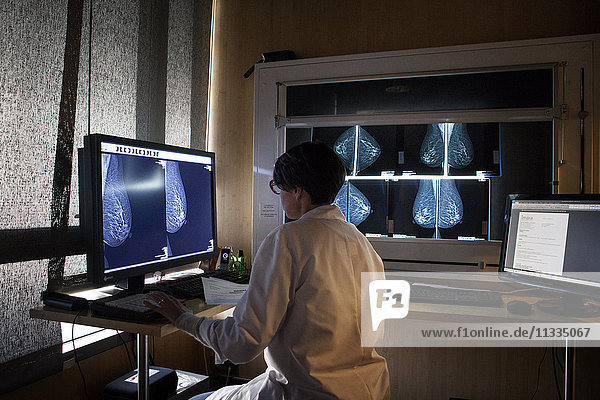 Reportage in a radiology centre in Haute-Savoie  France. A radiologist looks at the results of mammograms.