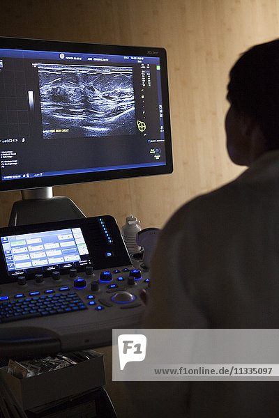 Reportage in einem radiologischen Zentrum in Haute-Savoie  Frankreich. Ein Radiologe führt eine Brustuntersuchung durch. Die Untersuchung zeigt das Vorhandensein von Zysten.