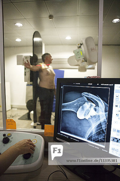 Reportage in einem radiologischen Zentrum in Haute-Savoie  Frankreich. Ein Techniker führt eine Arthographie der Schulter mit Arthrose durch.