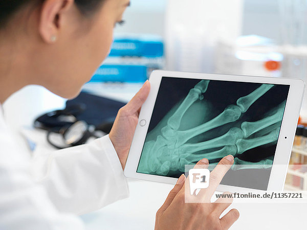 Doctor viewing X-ray of hand on digital tablet