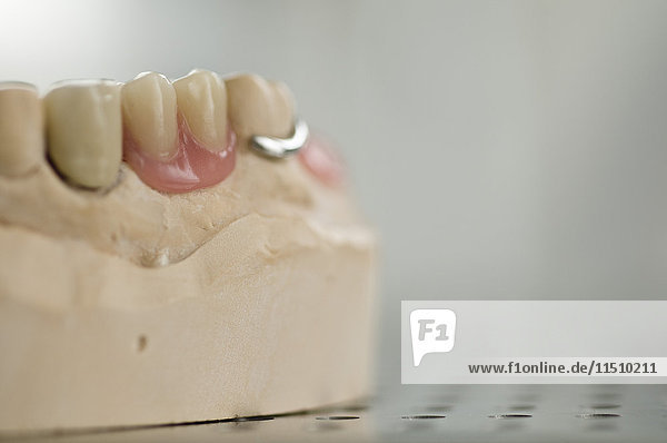 Falsche Zähne in einem Dentallabor
