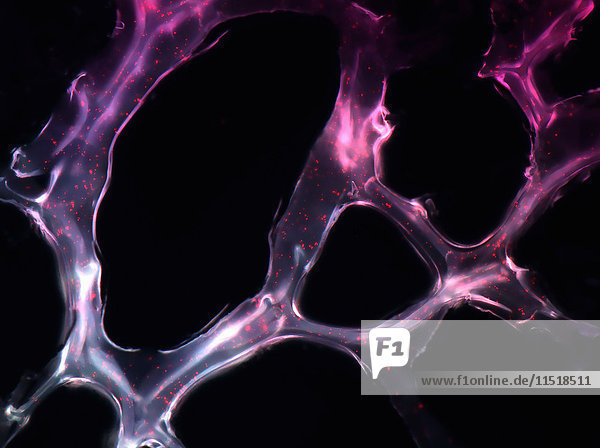 Selbstorganisierte Nanopartikel  die Mikro-RNAs zum Brusttumor in einem Mausmodell tragen und am Tumorziel haften