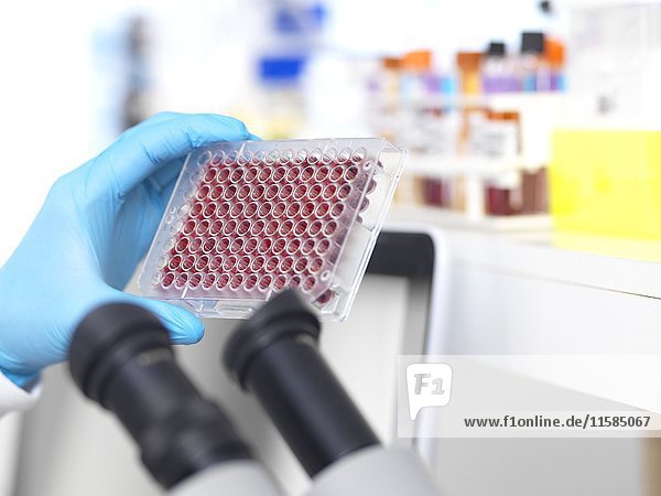 Wissenschaftlerin  die Multiwell-Platten mit Blutproben für Tests und Analysen im Labor vorbereitet