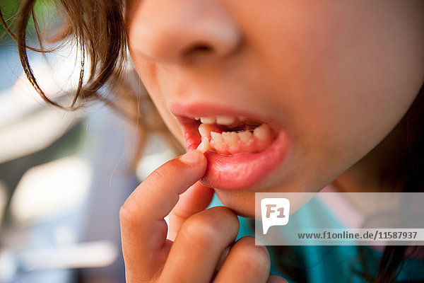 Mädchen berührt lockeren Zahn