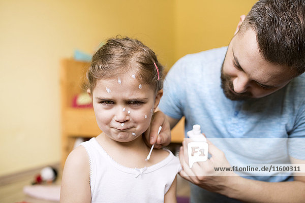 Father at home caring for daughter having chickenpox