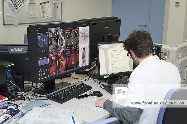 Reportage on PET imaging at the Antoine-Lacassagne Cancer centre in Nice  France. Positron Emission Tomography  or PET scan  is used in diagnosing and monitoring patients with cancer. This method enables tumours to be detected using a radioactive tracer  which accumulates heavily in cells that present a pathological hypermetabolism. The scintigraphy doctors interpret the results and write up their reports.