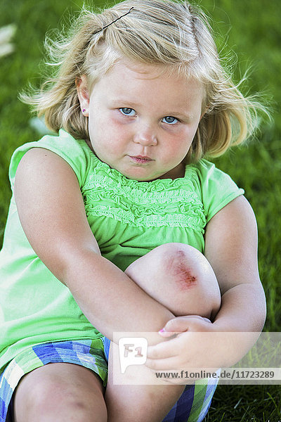'A young girl sits on the grass looking unhappy while holding her knee that has a scrape on it; Oregon  United States of America'