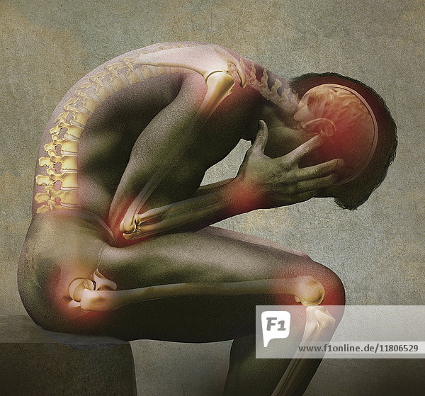 Computergeneriertes Bild eines gebeugten  an Gelenkschmerzen leidenden Mannes