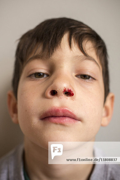 Porträt eines gemischtrassigen Jungen mit blutiger Nase