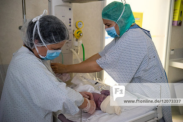 Reportage in the maternity service of Métropole Savoie hospital in Chambéry  France. A planned cesarean delivery. Intubation and placing a mask on the baby to help it breathe as it is having difficulty evacuating the liquid in its lungs (transient respiratory distress (TRD)).