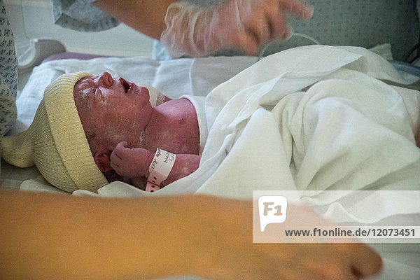 Reportage aus der Entbindungsstation des Krankenhauses Métropole Savoie in Chambéry  Frankreich. Eine geplante Entbindung per Kaiserschnitt.