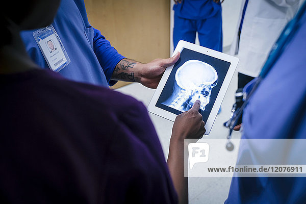 Ärzte untersuchen Röntgenaufnahmen von Schädel und Kiefer auf einem digitalen Tablet